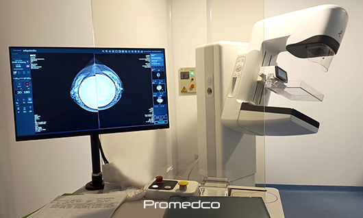 Mamografía digital en CDMX